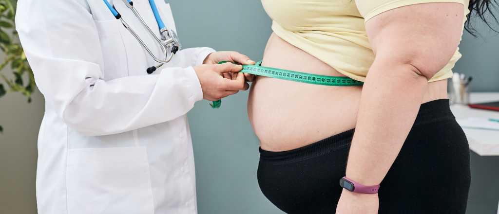 Hablemos de la obesidad