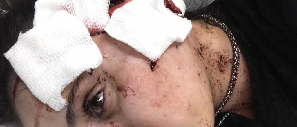 Con dolor, la moza agredida en la Arístides se lamentó: "Me arruinaron la cara"