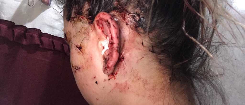 La moza desfigurada en la Ar&iacute;stides estaba en negro