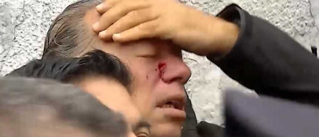 Berni avis&oacute; que no va a renunciar: "Un golpe no me hace mella"