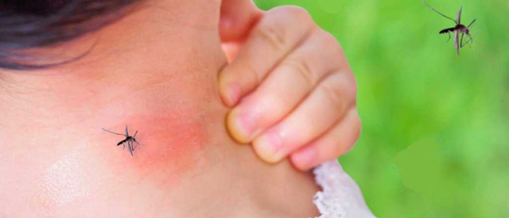 El dengue avanza en Argentina: casi 200 muertos y 269 mil contagios