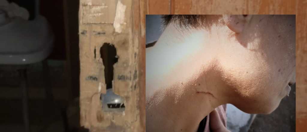 En el quinto robo a una mujer en San Mart&iacute;n, la golpean y le roban la garrafa