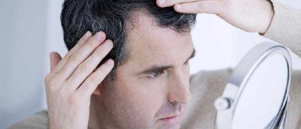 C&oacute;mo solucionar de una buena vez la caspa y el pelo graso