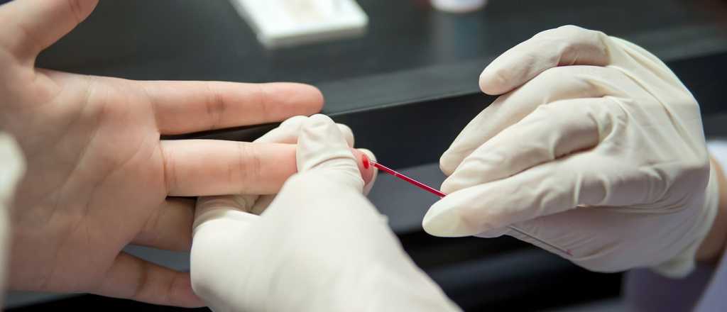 Godoy Cruz realizará testeos gratuitos de VIH