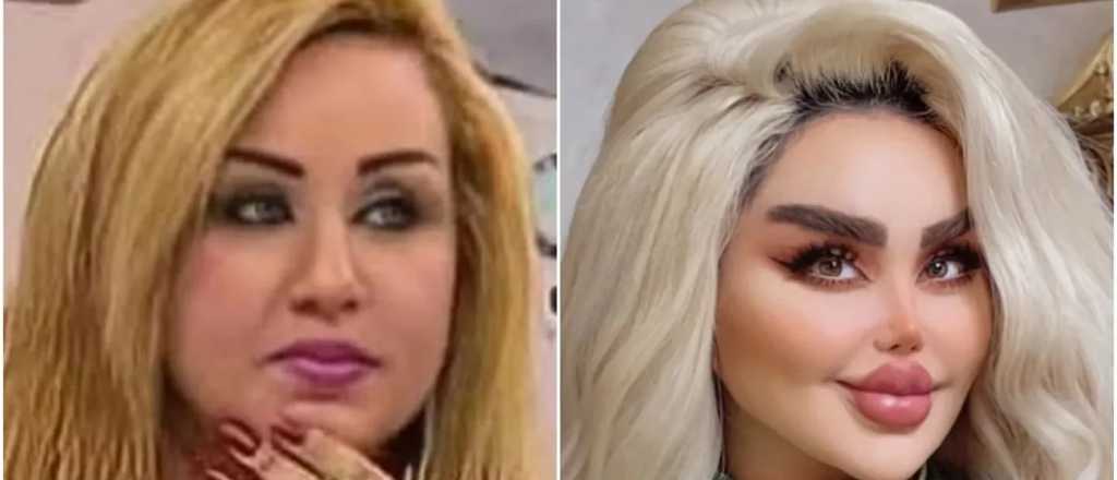 Quer&iacute;a parecerse a Barbie, se hizo 43 cirug&iacute;as est&eacute;ticas y as&iacute; qued&oacute;