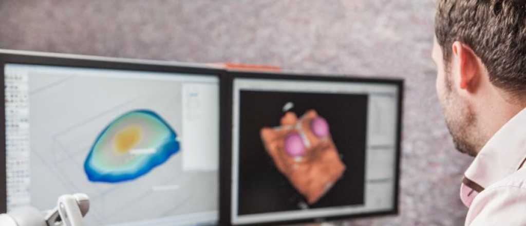 Un hospital bonaerense realizó cirugías con implantes 3D