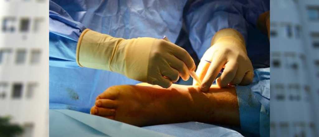 El Hospital Central operar&aacute; del pie a 9 pacientes gratis: &iquest;c&oacute;mo anotarse?