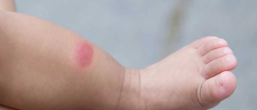 El mejor repelente para ponerle a tu bebé