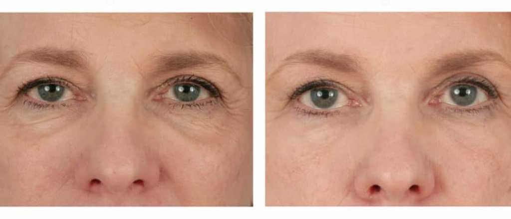 Los tratamientos est&eacute;ticos con Inteligencia Artificial que llegaron al pa&iacute;s