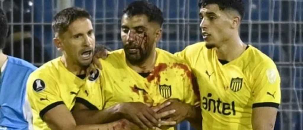 Papel&oacute;n: jugador de Pe&ntilde;arol fue agredido por un hincha de Central
