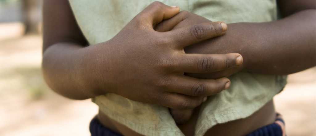 Unicef: 54 millones de ni&ntilde;os podr&iacute;an morir de hambre por el Covid