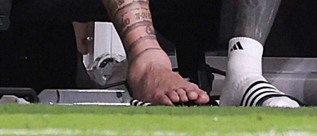 El Inter Miami dio a conocer la gravedad de la lesi&oacute;n de Messi