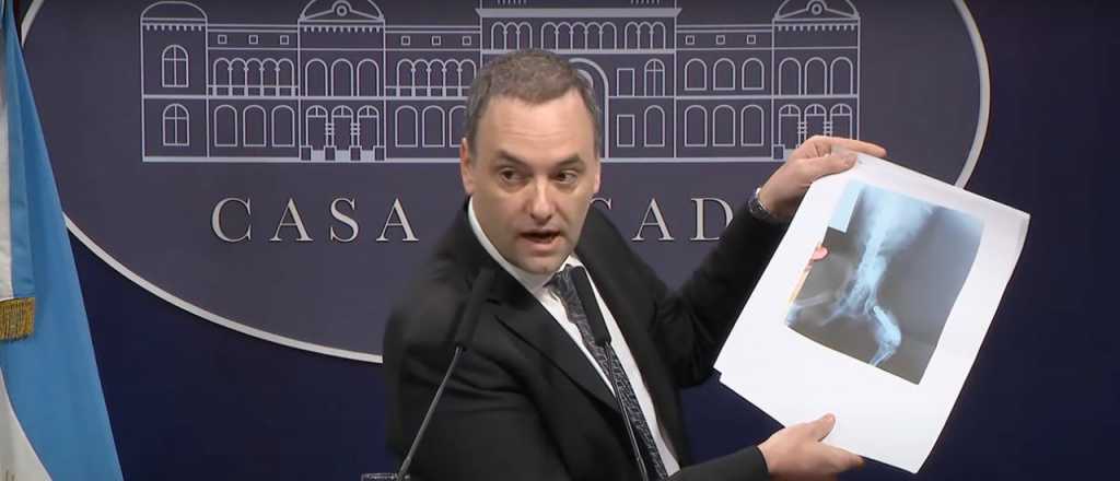 Reuni&oacute;n de diputados y represores: as&iacute; reaccion&oacute; el Gobierno