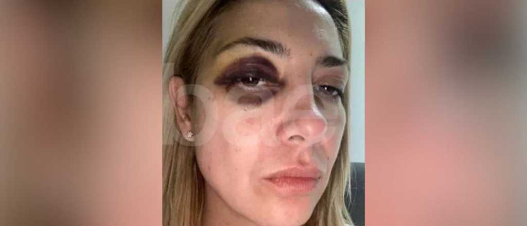 Aparecieron chats y fotos de Fabiola Y&aacute;&ntilde;ez golpeada