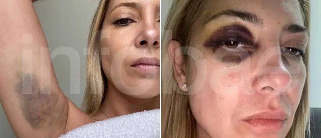 Declar&oacute; Fabiola Ya&ntilde;ez que sufri&oacute; "agresiones f&iacute;sicas estando embarazada"