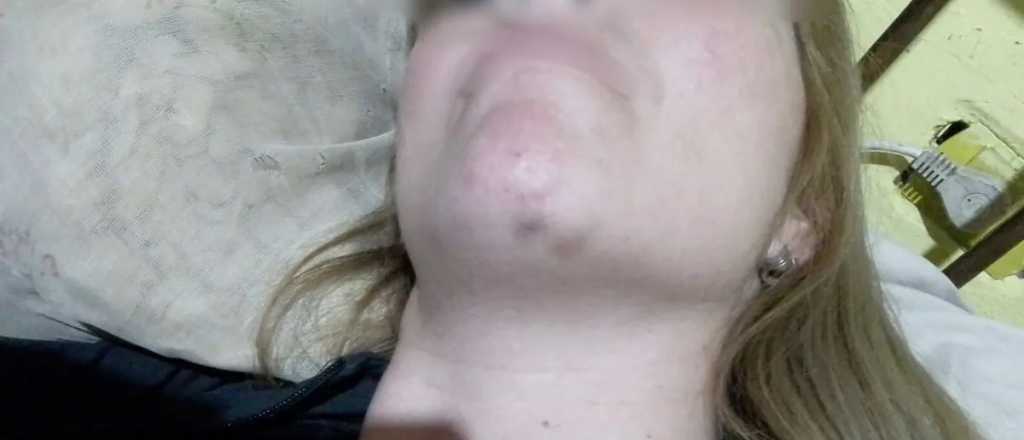 Filtran fotos de las lesiones de la mujer que denunci&oacute; a los rugbiers franceses