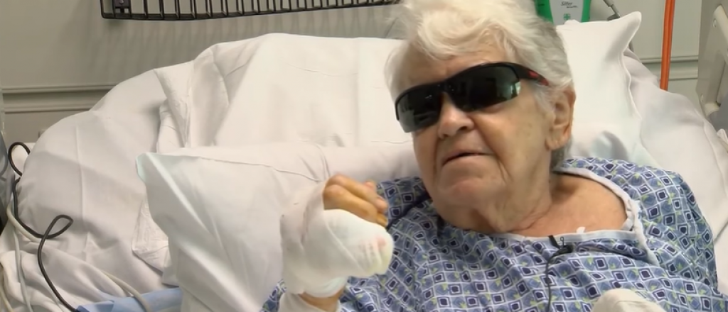 Sobrevivi&oacute; al ataque de un caim&aacute;n en Florida, pero perdi&oacute; varios dedos