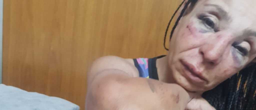 Feroz ataque a una mujer para robarle la bicicleta en Luj&aacute;n