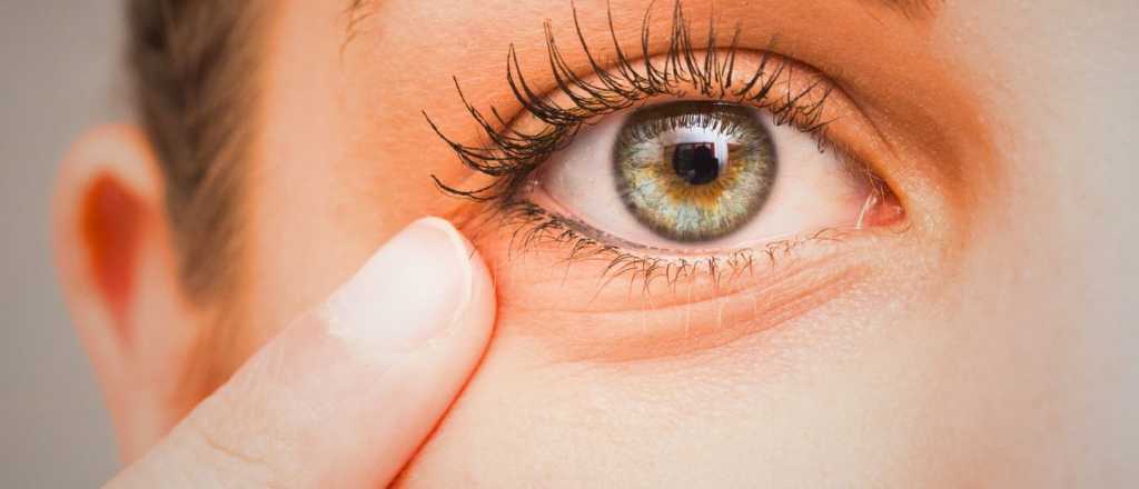 Orzuelos: c&oacute;mo curarlos y qu&eacute; remedios naturales evitar