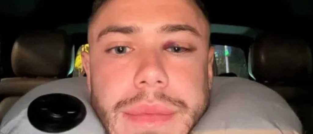 Conechny recibió el alta tras sufrir una fisura en el cráneo