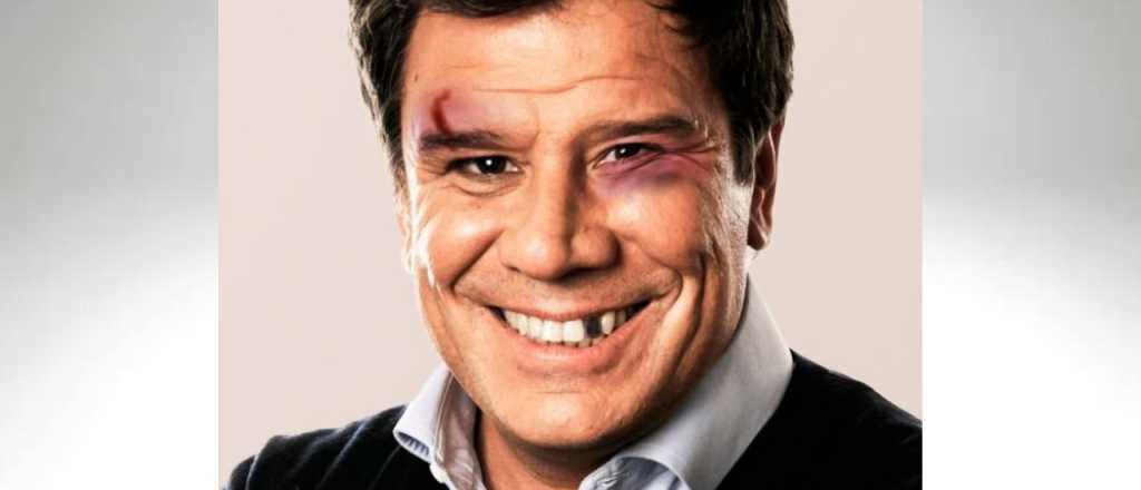 La burla de Lilia Lemoine a un Manes "golpeado"