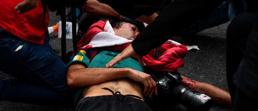 Un fotógrafo resultó herido en la marcha y Bullrich argumentó que es kirchnerista