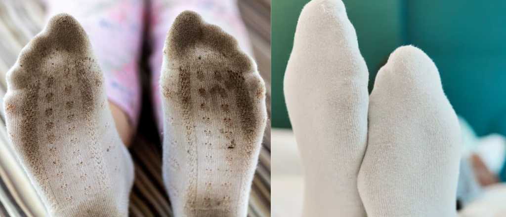 Medias blancas amarillentas o muy sucias: ¿cómo dejarlas "nuevas"?
