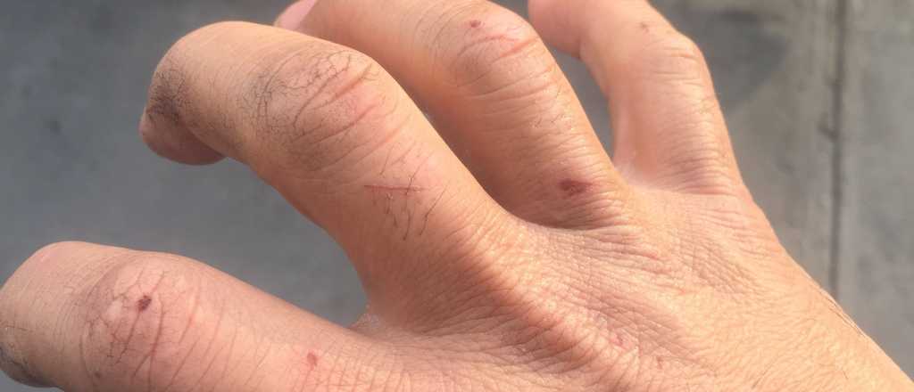 Cómo cuidar tu piel en invierno