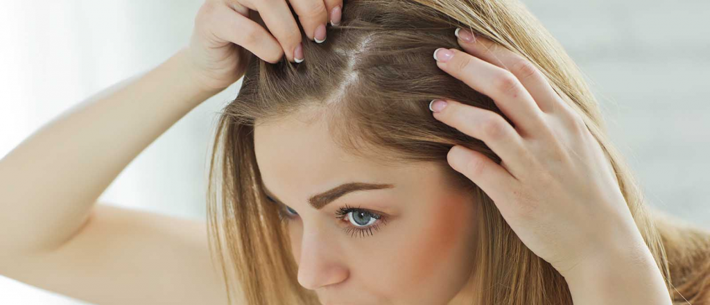 Lo que el stress le hace a tu pelo