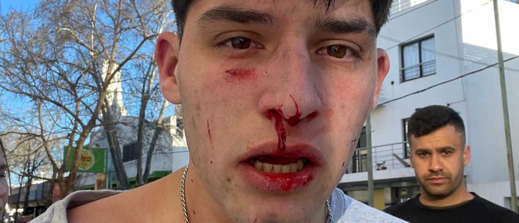 Militantes kirchneristas golpearon a seguidores de Milei