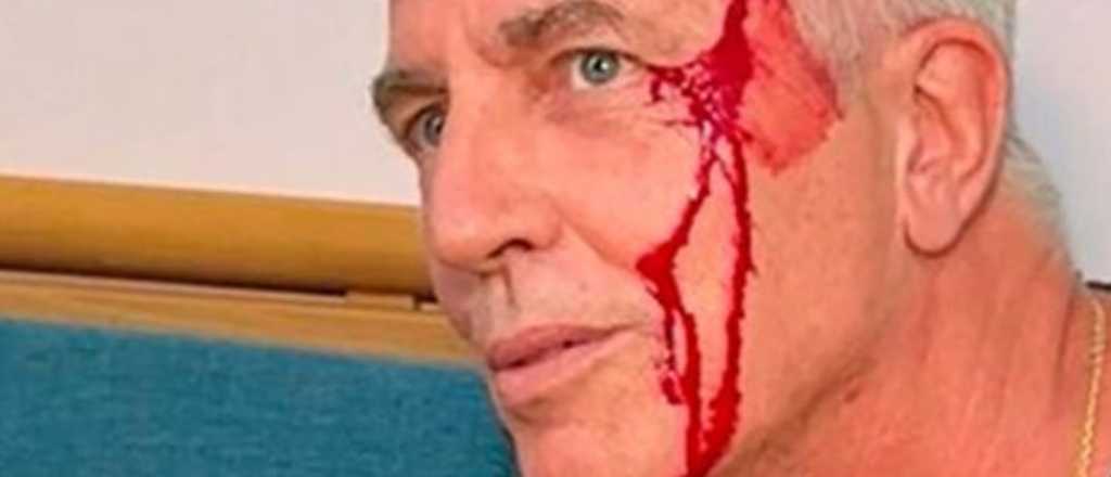 El grave accidente que sufrió Marley en las catacumbas