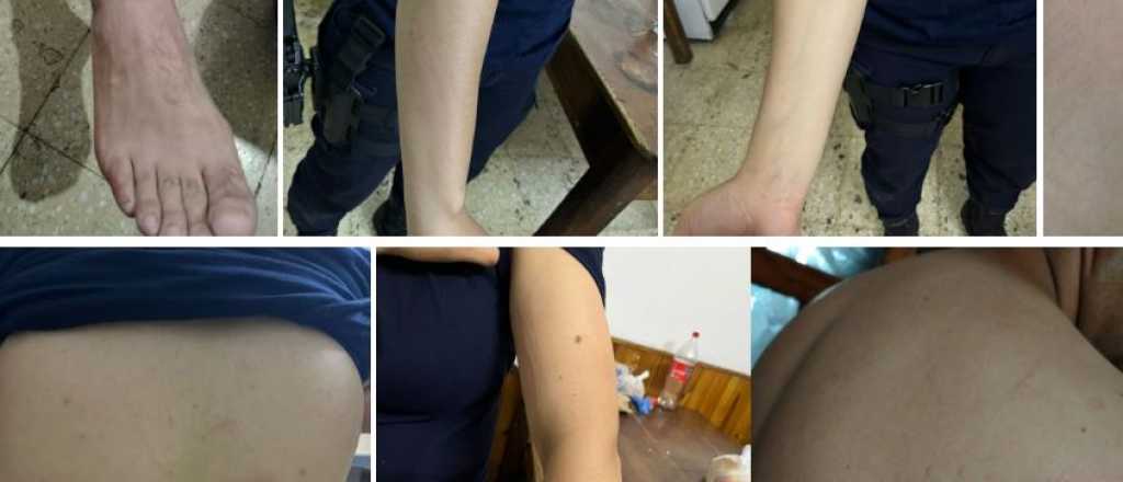 El Gobierno desmintió a Félix y denunció policías golpeados en San Rafael