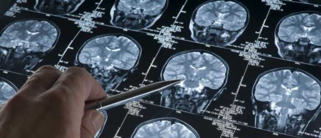 Las claves del estudio que genera esperanza contra el Alzheimer