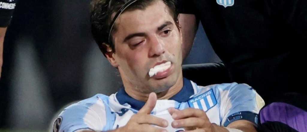 Santi Sosa se perder&iacute;a la vuelta ante Flamengo tras el golpe de Rojo