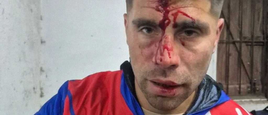 Locura total: le clavaron una llave en la cabeza a un jugador del ascenso