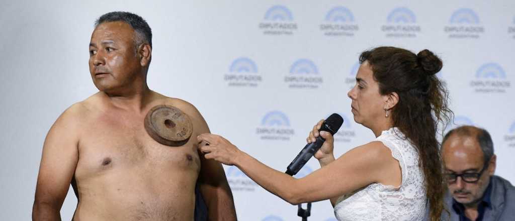 Qué dice la ciencia sobre la supuesta "magnetización" por vacunas