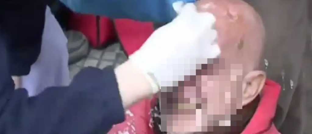 Un jubilado fue golpeado durante un asalto en su casa de San Mart&iacute;n