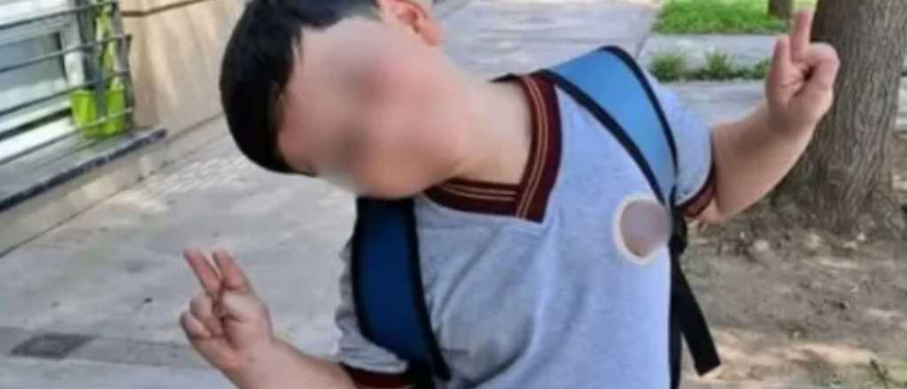 Bastián fue trasladado a una clínica privada tras una evolución favorable