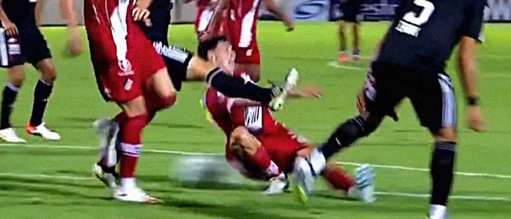 Video: Arno ser&aacute; operado tras la escalofriante lesi&oacute;n ante Riestra