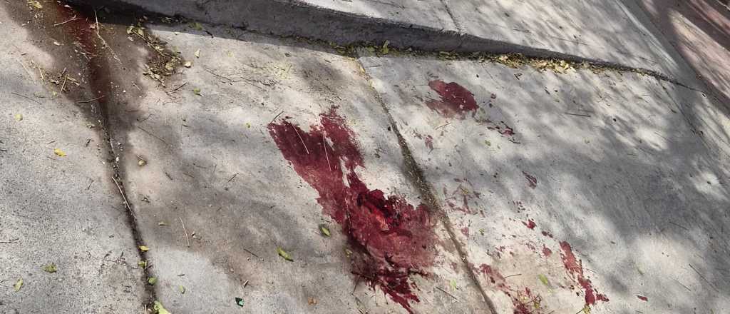 Guaymallén: violó la restricción de acercarse a su ex y se fue apuñalado