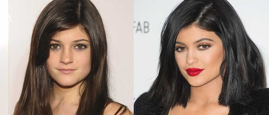 Irreconocible: as&iacute; era el rostro de Kylie Jenner antes de la fama