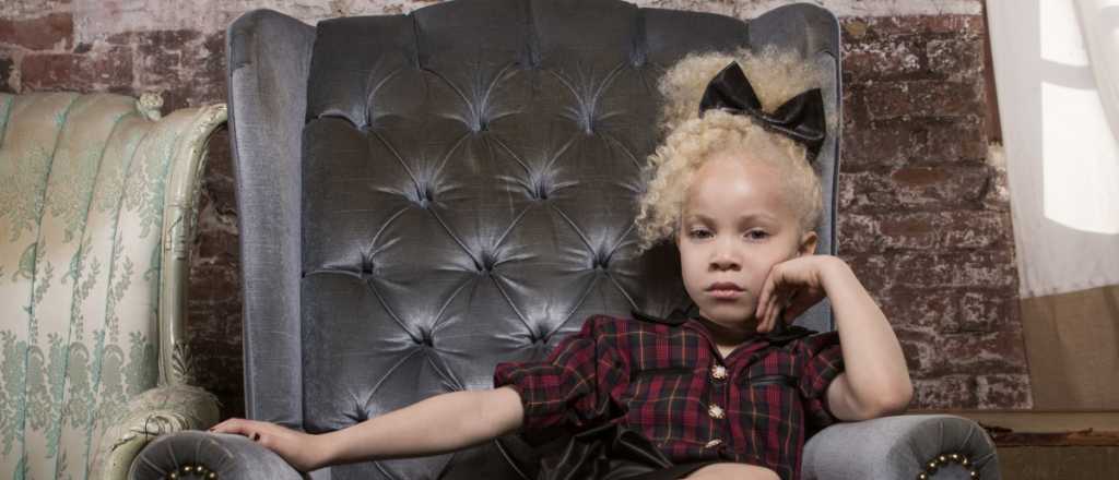 Tiene 8 a&ntilde;os, es albina y supermodelo