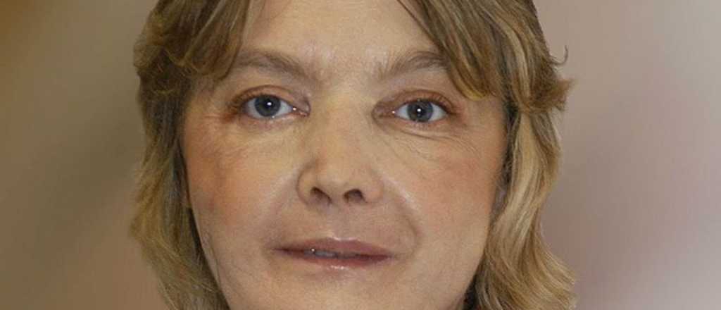 Murió la mujer que recibió el primer trasplante de cara del mundo