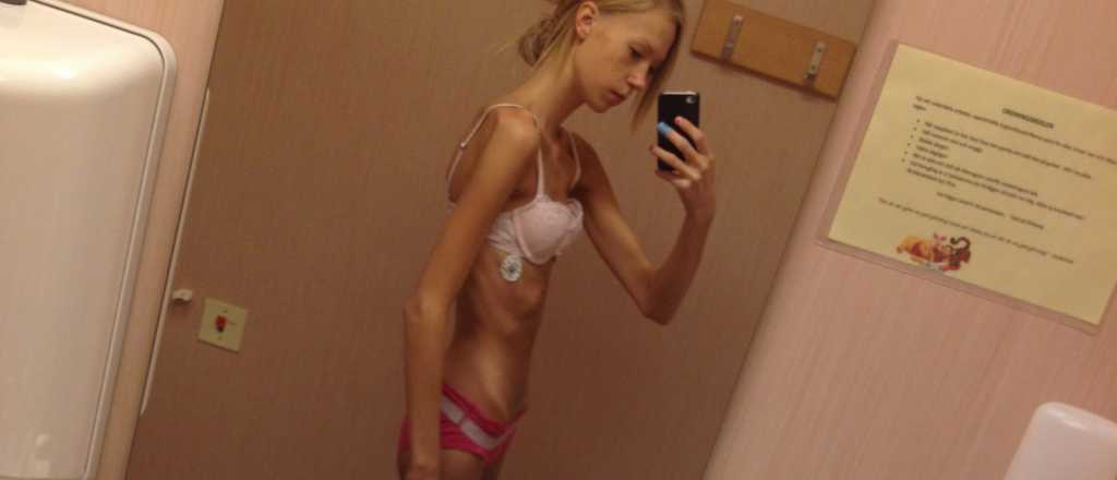 Casi muere por anorexia y hoy es una �bomba fitness�