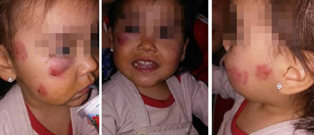 Denuncian golpes a una nena en una guardería de Godoy Cruz