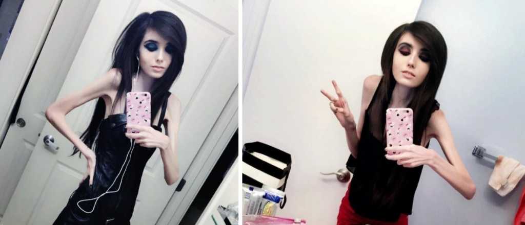 Pol&eacute;mica por una youtuber que pesa s&oacute;lo 27 kilos